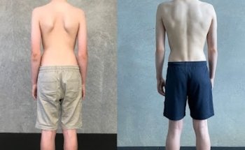 Central Coast Biomechanics
