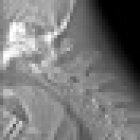 Espoon Keskuksen Fysioterapia